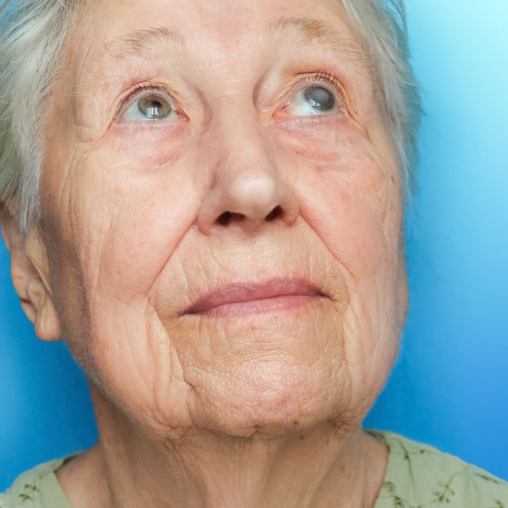 Senior Woman with cataracts
